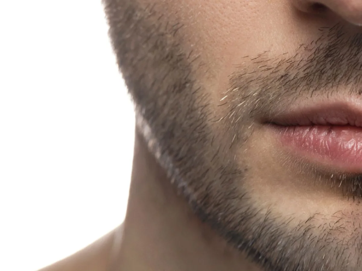 Shape — Before