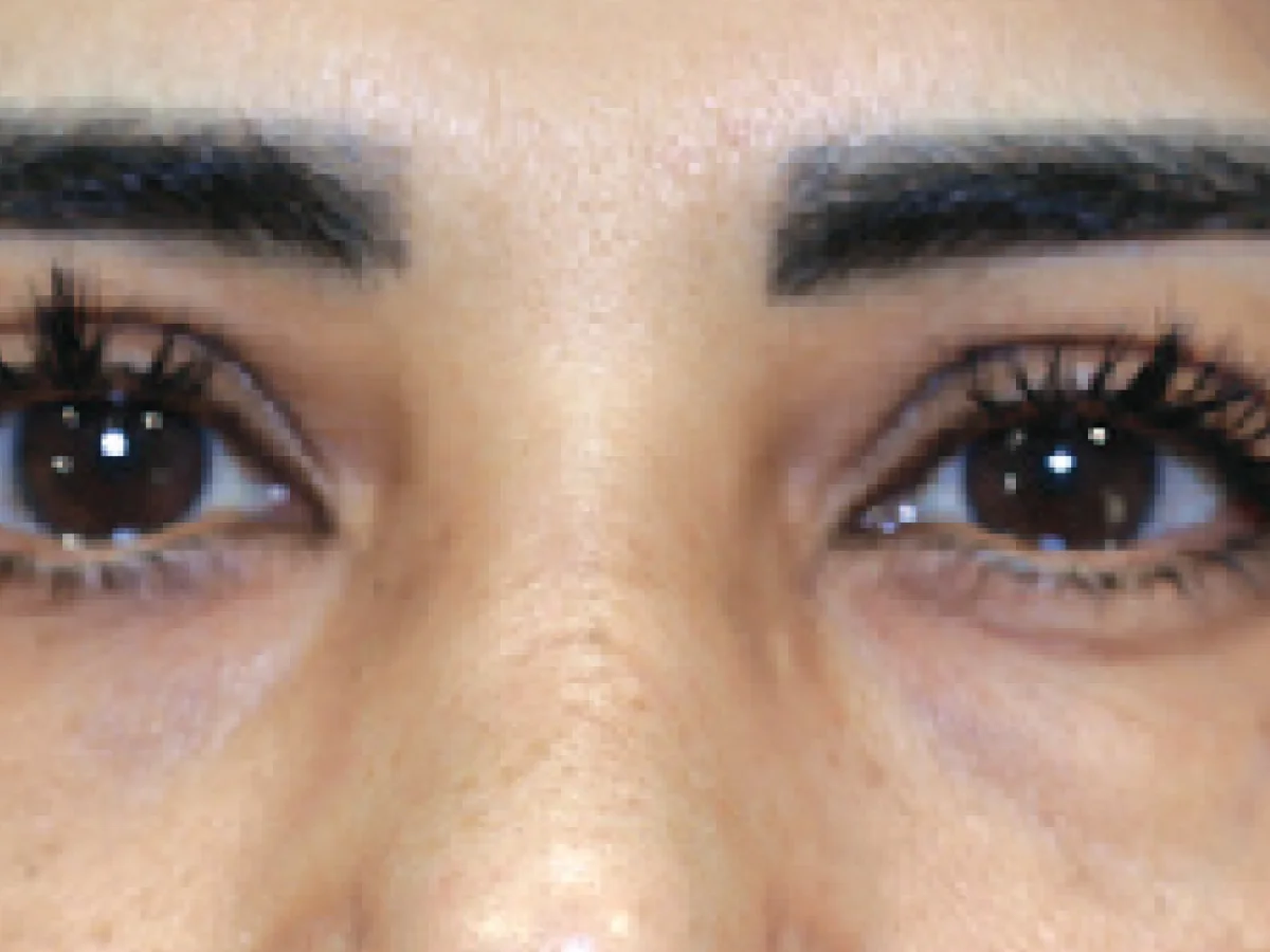 سیلک — قبل